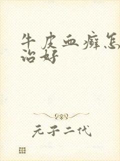 牛皮血癣怎么能治好