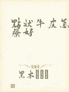 点状牛皮怎么治疗好