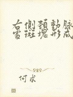 右侧颈动脉分叉处斑块形成