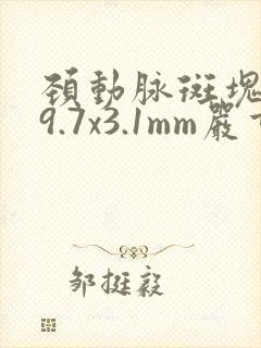 颈动脉斑块左侧9.7x3.1mm严重吗?