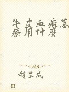 牛皮血癣怎么治疗用什么