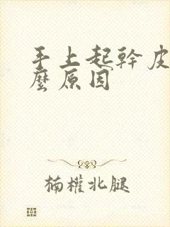 手上起干皮是什么原因