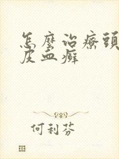 怎么治疗头上牛皮血癣