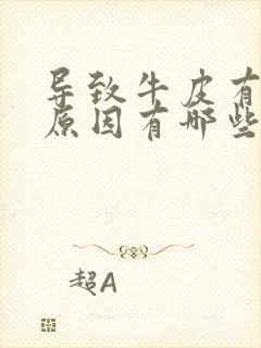 导致牛皮有癣的原因有哪些