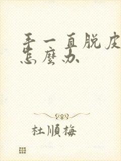 手一直脱皮开裂怎么办