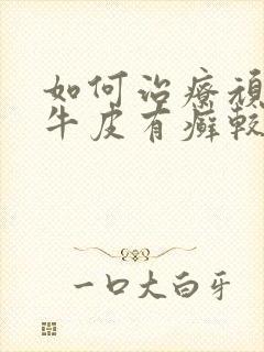 如何治疗顽固性牛皮有癣较好