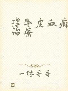 得牛皮血癣怎么治疗