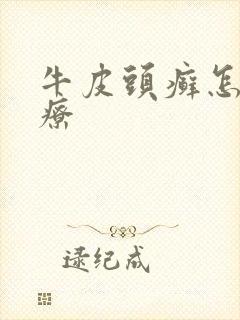 牛皮头癣怎么治疗