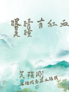 眼睛有红血丝戴美瞳