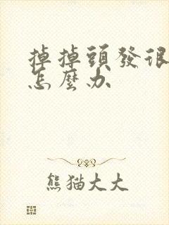 掉掉头发很厉害怎么办