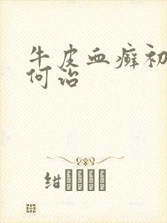 牛皮血癣初期如何治