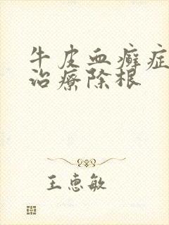 牛皮血癣症怎么治疗除根