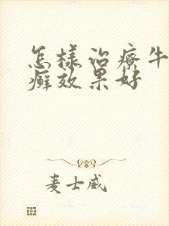 怎样治疗牛皮血癣效果好