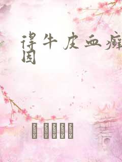 得牛皮血癣的原因