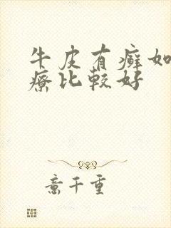 牛皮有癣如何治疗比较好