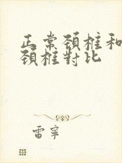 正常颈椎和反弓颈椎对比