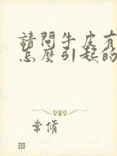 请问牛皮有癣是怎么引起的