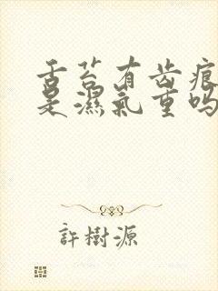 舌苔有齿痕一定是湿气重吗