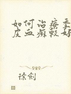 如何治疗季节牛皮血癣较好