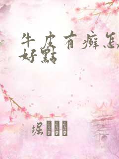 牛皮有癣怎么治好点