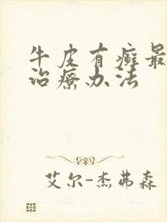 牛皮有癣最好的治疗办法