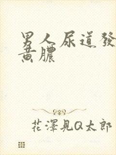 男人尿道发炎流黄脓