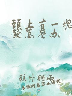 头上有一块没头发怎么办