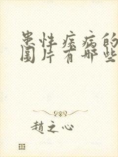 患性疾病的症状图片有哪些