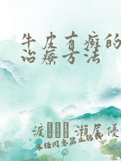 牛皮有癣的最佳治疗方法
