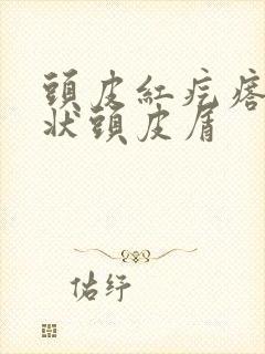 头皮红疙瘩有块状头皮屑