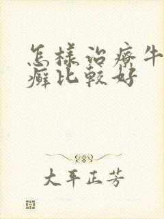 怎样治疗牛皮有癣比较好