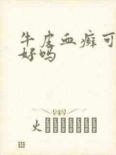 牛皮血癣可以治好吗