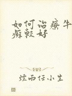 如何治疗牛皮有癣较好