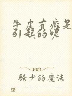 牛皮有癣是怎么引起的呢