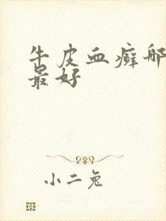 牛皮血癣哪里治最好