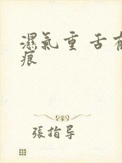 湿气重 舌有齿痕