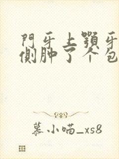 门牙上颚牙龈内侧肿了个包