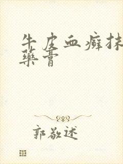 牛皮血癣抹什么药膏