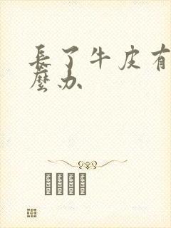 长了牛皮有癣怎么办