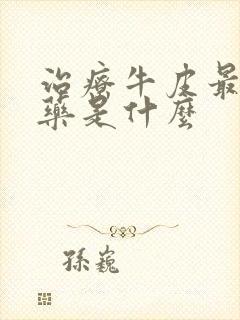 治疗牛皮最好的药是什么