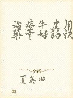 治疗牛皮用什么药膏好的快一点