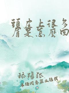 头皮上很多头皮屑是怎么回事