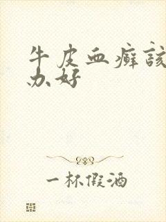 牛皮血癣该怎么办好