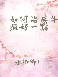 如何治疗牛皮有癣好一点