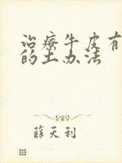 治疗牛皮有癣好的土办法