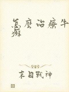 怎么治疗牛皮选癣