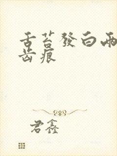 舌苔发白两侧有齿痕