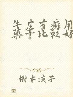 牛皮有癣用什么药膏比较好