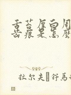 舌苔厚白周围有齿痕是怎么回事