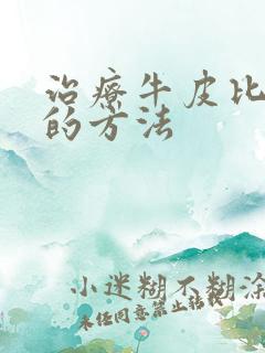 治疗牛皮比较好的方法